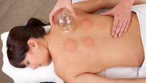 Terapi Bekam Jadi Pilihan Pengobatan Alternatif Populer
